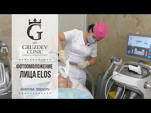 Видео: Фотоомоложение лица ELOS (элос).  Аппаратная косметология