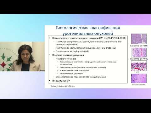 Видео: Этиология, эпидемиология, метастазирование, классификация и диагностика уротелиального рака