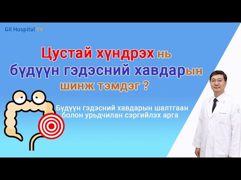 Видео: Цустай хүндрэх нь бүдүүн гэдэсний хавдарын шинж тэмдэг ?