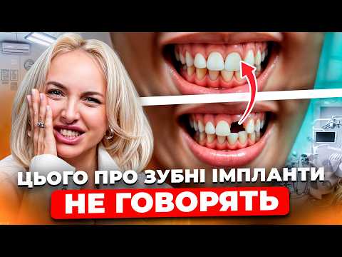 Видео: ПРАВДА ПРО ІМПЛАНТИ ЗУБІВ. Як НЕ ЛОХАНУТИСЬ у стоматолога? Скільки ПОВИНЕН КОШТУВАТИ імплант?