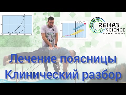 Видео: Боль в пояснице. Клинический разбор в мануальной терапии.