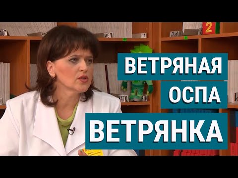 Видео: Ветрянка. Прививка от ветряной оспы  нужна ли она?