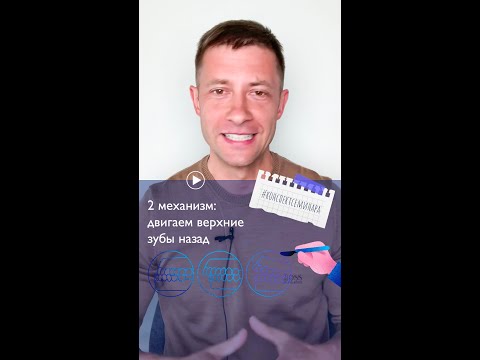 Видео: 3. Второй механизм: движение верхних зубов назад | #конспектсеминара