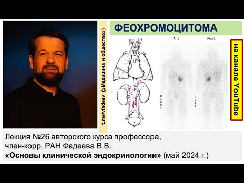 Видео: ФЕОХРОМОЦИТОМА