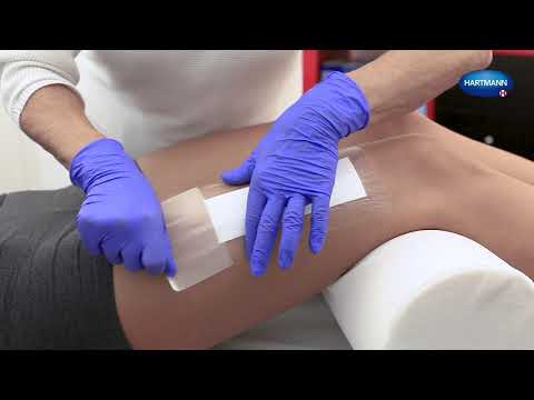 Видео: Наложение повязки Hydrofilm plus (инструкция)