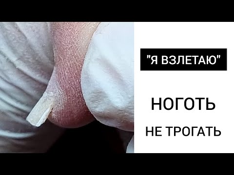 Видео: ВЗЛЕТНЫЙ ноготь  // Любимый Василек