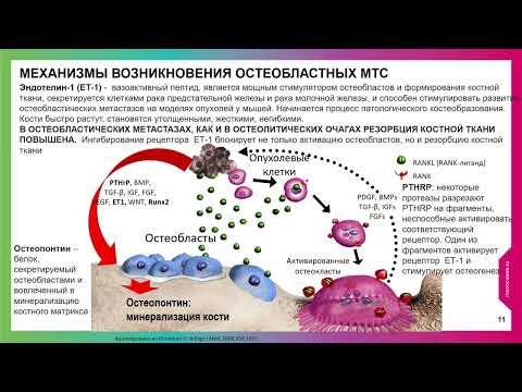 Видео: Бессимптомные метастазы в кости при раке молочной железы: лечить, нельзя наблюдать