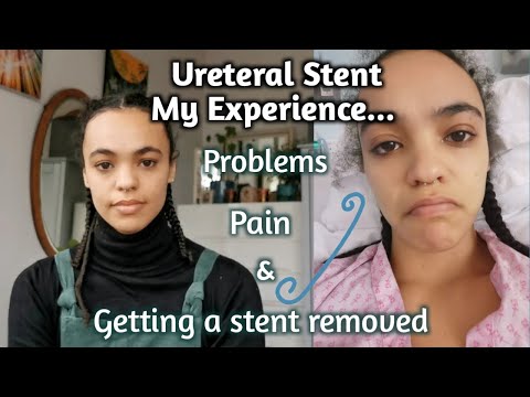 Видео: Мой болезненный опыт с мочеточниковым стентом