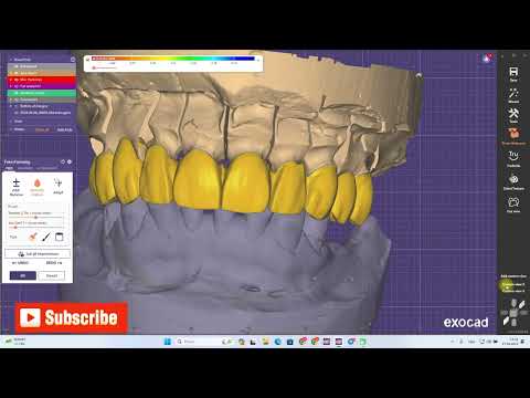 Видео: Exocad add Extra teeth. Добавить подвеску правильно если забыли.Podveska qushish.