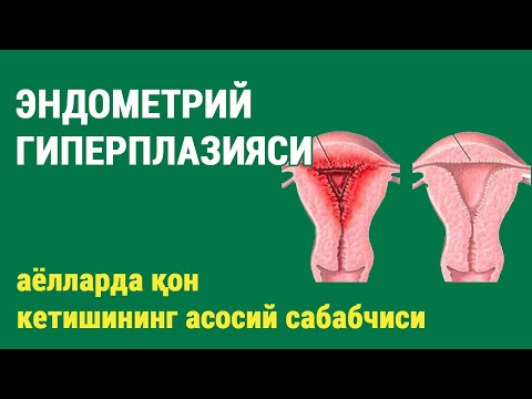 Видео: Эндометрий гиперплазияси: аёлларда қон кетишининг асосий сабабчиси