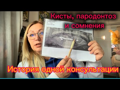 Видео: Откровенно: Когда врач не внушает доверия… Мои размышления после приёма