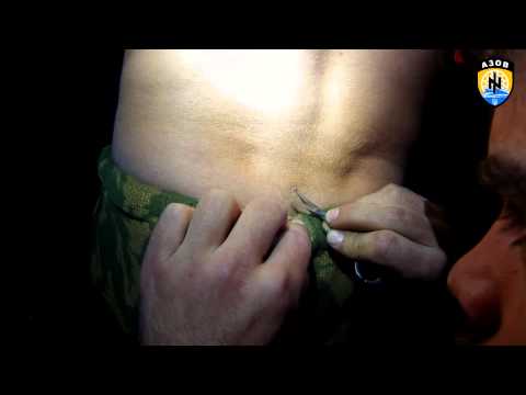 Видео: Извлечение осколка из спины товарища