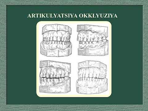 Видео: Артикуляция Оклюзия ва уларни турлари