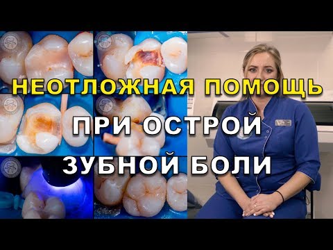 Видео: Острая зубная боль в зубе – что делать и как избавиться? (Видео) Люми-Дент Киев (Зубний біль)