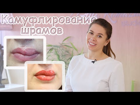 Видео: Камуфлирование шрамов