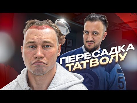 Видео: ПЕРЕСАДКА ВОЛОС ТАТВОЛУ