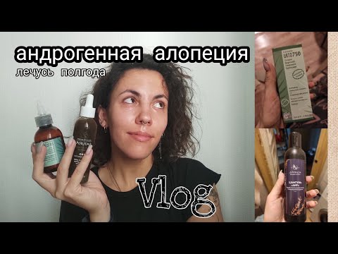 Видео: Андрогенная алопеция | гиперандрогения | результаты полугодового лечения | новые лекарства