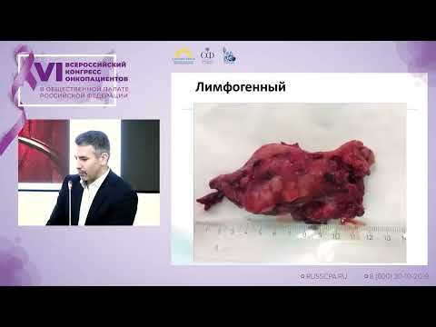 Видео: Морхов Константин Юрьевич - Диагностика и лечение рака яичников