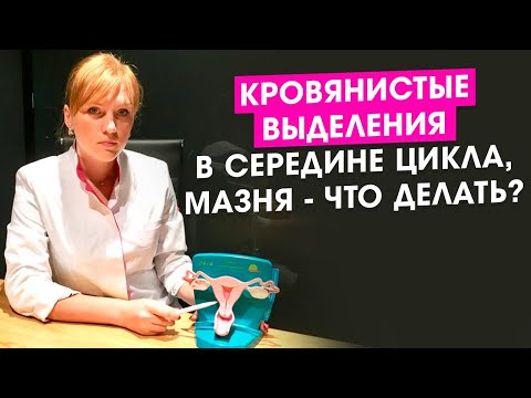Видео: Кровянистые выделения в середине цикла. Мазня. Что делать?