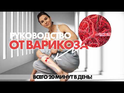 Видео: Все что вам НУЖНО делать от Варикоза. Начните как можно раньше!