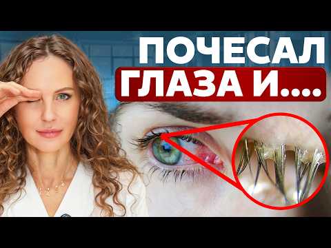 Видео: Вот почему нельзя ЧЕСАТЬ глаза! Правила, которые помогут тебе сохранить ЗРЕНИЕ