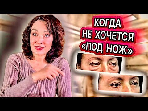 Видео: Массирую с утра обязательно: точки для массажа, чтобы поднять веки, убрать мешки и отеки 