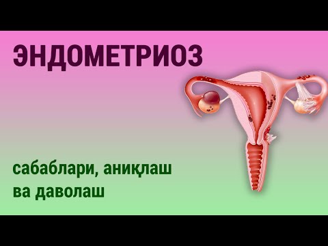 Видео: Эндометриоз: сабаблари, аниқлаш ва даволаш.