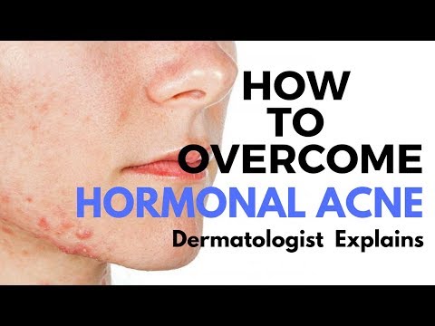 Видео: Советы по уходу за кожей: лечение гормонального акне