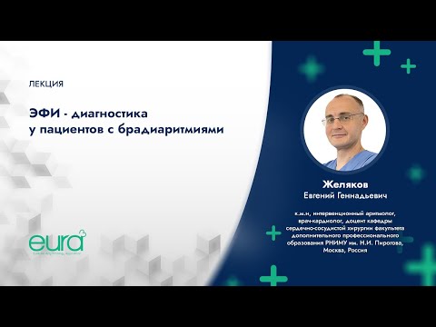 Видео: «ЭФИ - диагностика у пациентов с брадиаритмиями»