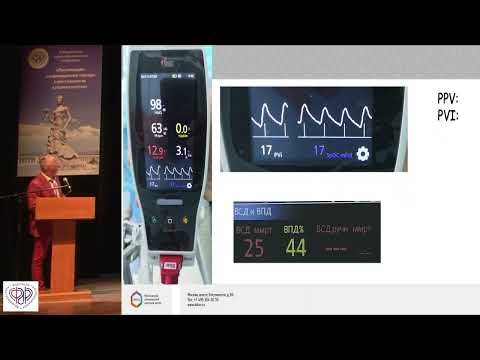 Видео: Субботин Валерий. Мониторинг в цель-ориентированной инфузионной терапии.
