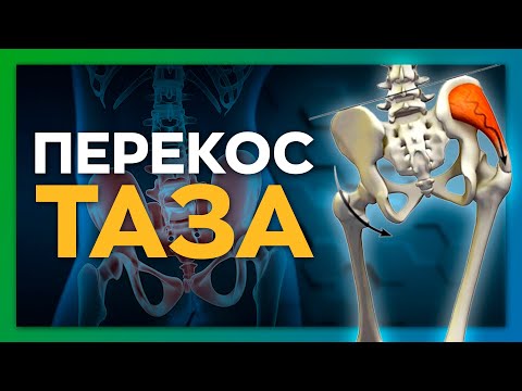 Видео: Упражнение, чтобы выровнять таз и снять защемления. Шаги к здоровью. Сезон 2. Серия 3