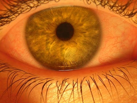 Видео: Рав Финкель. Что такое СГЛАЗ и как с ним бороться