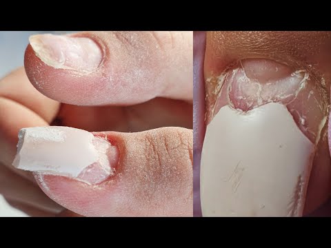 Видео: ПОСТРАДАЛА ОТ маникюра 😱😿