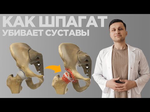 Видео: Печальные последствия ШПАГАТА. Почему Вам НЕ НУЖЕН шпагат.