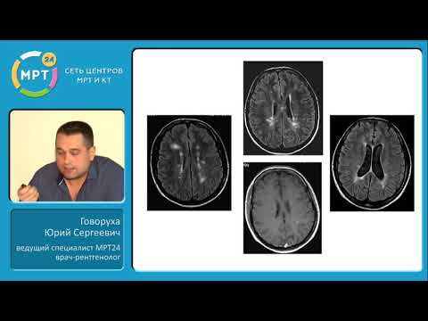 Видео: Патологии головного мозга