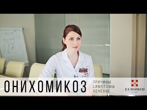 Видео: Онихомикоз: симптомы, причины, лечение.