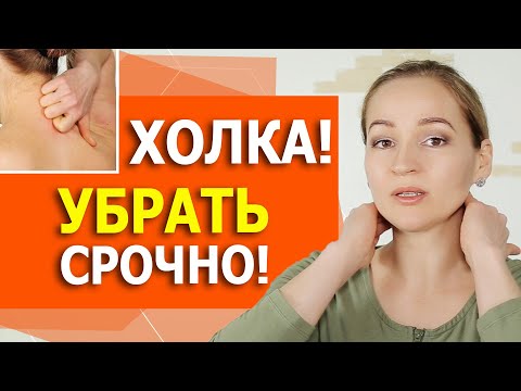 Видео: Чем опасна холка? Полный комплекс как убрать холку. Вдовий горб.