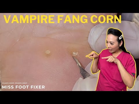 Видео: Глубокая кукуруза на ногах