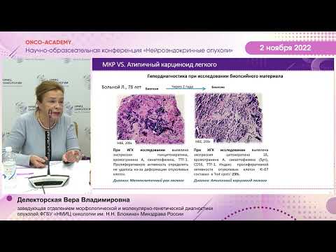 Видео: Проблемы классификации НЭН легких и тимуса. Делекторская В. В.