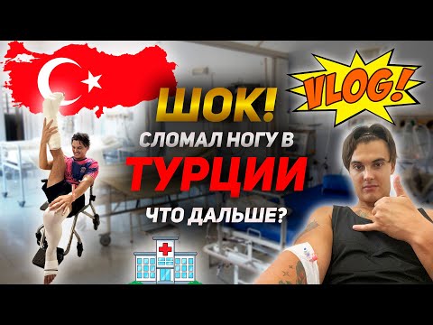 Видео: ШОК! Сломал ногу во время работы за границей! ЧТО ДАЛЬШЕ? | ВЛОГ 3