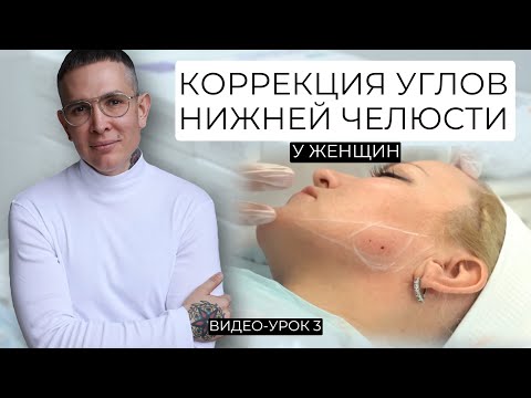 Видео: Коррекция углов нижней челюсти у женщин Видео-Урок | Профиль Джоли