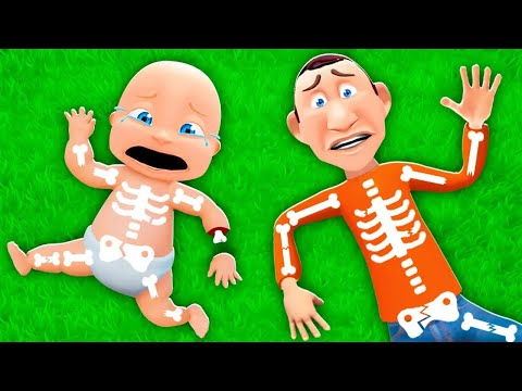 Видео: НАШИ КОСТИ СЛОМАЛИСЬ?!