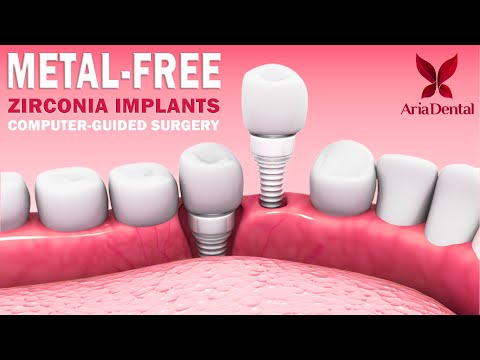 Видео: Безметалловые циркониевые имплантаты и компьютерно-управляемая циркониевая имплантация