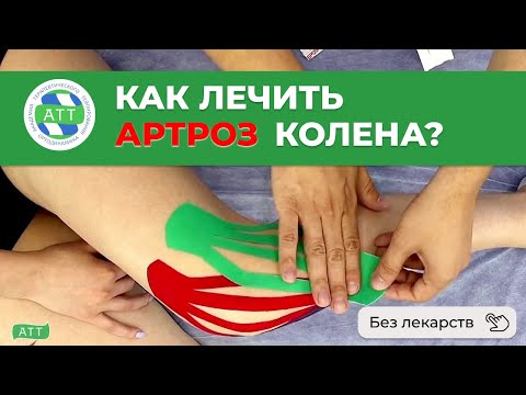 Видео: ✅ Артроз колена Тейпирование колена при артрозе