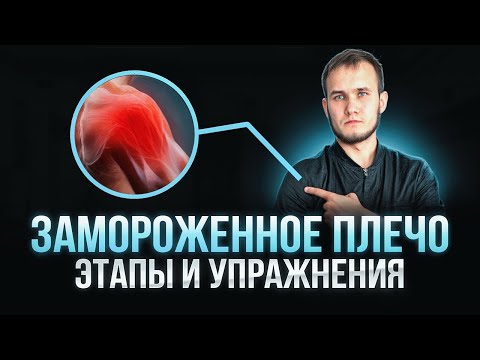 Видео: За 5 месяцев ты вылечишь ЗАМОРОЖЕННОЕ ПЛЕЧО. Упражнения и этапы восстановления
