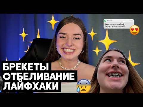 Видео: ИДЕАЛЬНЫЕ ЗУБЫ ТЫ ЭТОГО НЕ ЗНАЛ //мой опыт // лайфхаки