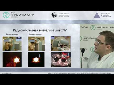 Видео: Биопсия сигнального лимфоузла