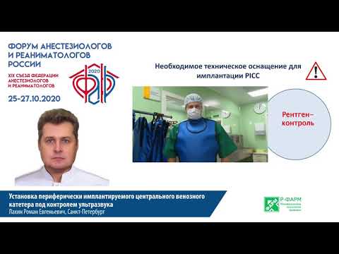 Видео: Установка имплантируемого ЦВК под УЗИ Лахин Р.Е.