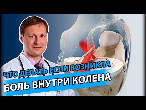 Видео: КРЕСТООБРАЗНЫЕ СВЯЗКИ | Как распознать и лечить повреждения