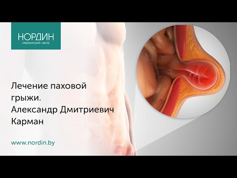 Видео: Лечение паховой грыжи, врач Александр Карман